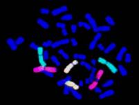 metaphase chromosome